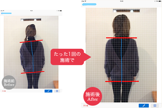 施術前後の比較画像