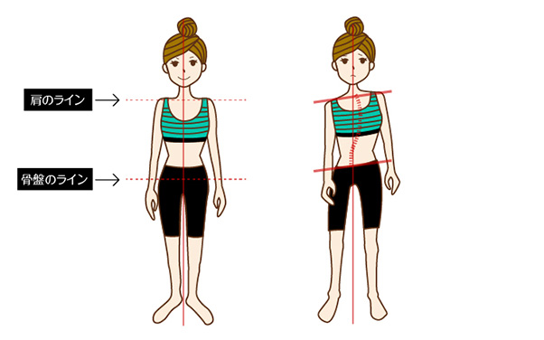 体の歪みイメージ